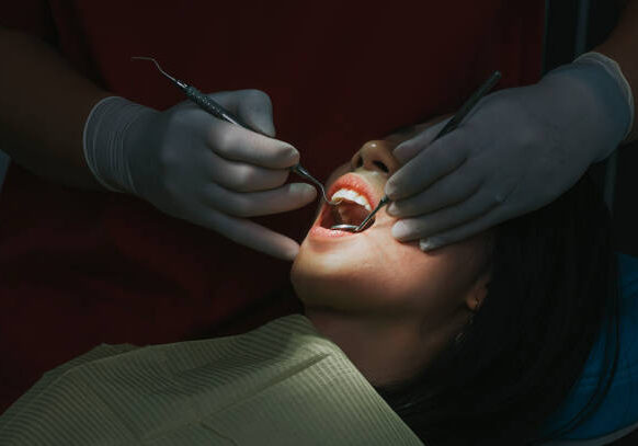 close up Asian Chinese female patient open mouth for dentist examining her tooth routine check up