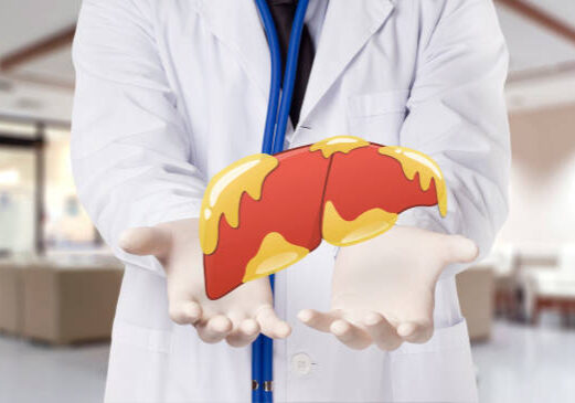 doctor touch fatty on liver , concept fatty liver in hospital